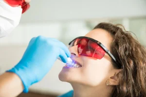 Boulevard Dental - Teeth Whitening Service in Saskatoon